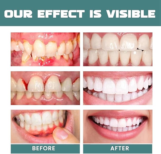 EELHOE Herbal Mouth Relief Spray 25ml