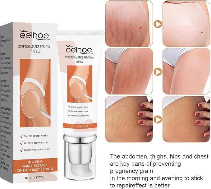 EELHOE Stretch Mark Repair Cream 45g