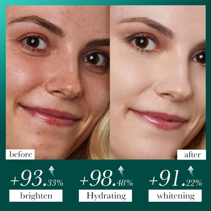 SADOER Deep Cleansing Peel-Off Mask – Pore Purifying & Brightening Formula