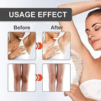 Snow Bleach Intensive Dark Spot Remover Cream